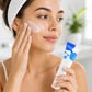 Azelaic Acid Acne Cream