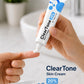 Azelaic Acid Acne Cream